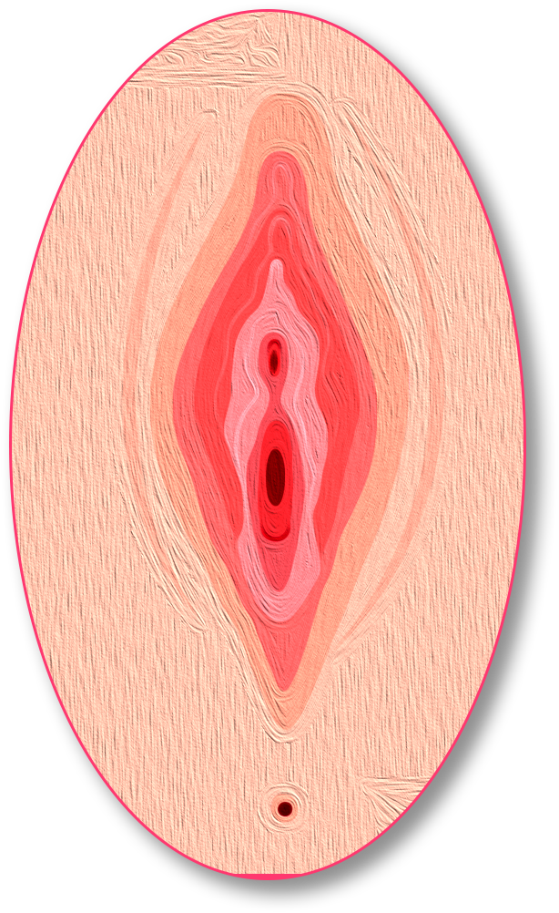 perinoplastia